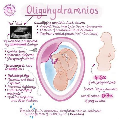 Oligohydramnios: Causes, Symptoms, Diagnosis & Treatment